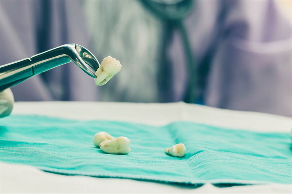 一位34歲病患拔20顆牙齒回家後陷入昏迷，搶救9天仍回天乏術，讓家屬質疑是拔牙導致。不過牙科權威指出，其實拔1顆牙和拔20顆牙的風險是相同的。(圖/Shutterstock)
