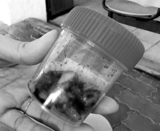 嘉义县34岁郑姓女子4日到嘉义基督教医院进行拔牙手术，过程中共拔掉20颗龋齿，隔天就陷入昏迷疑断气。（吕妍庭摄）