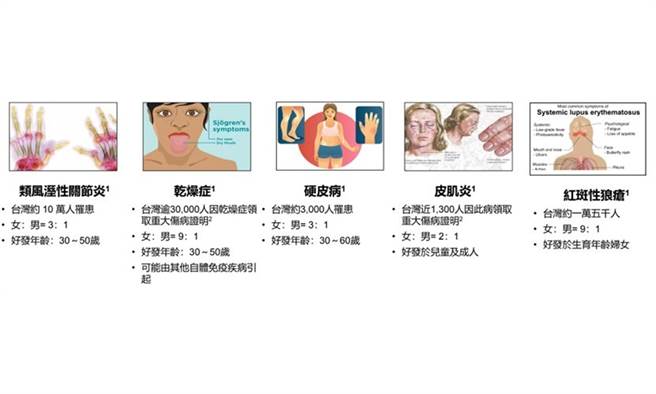 常见的自体免疫疾病。(图片来源：蔡长佑教授/康健杂志提供)