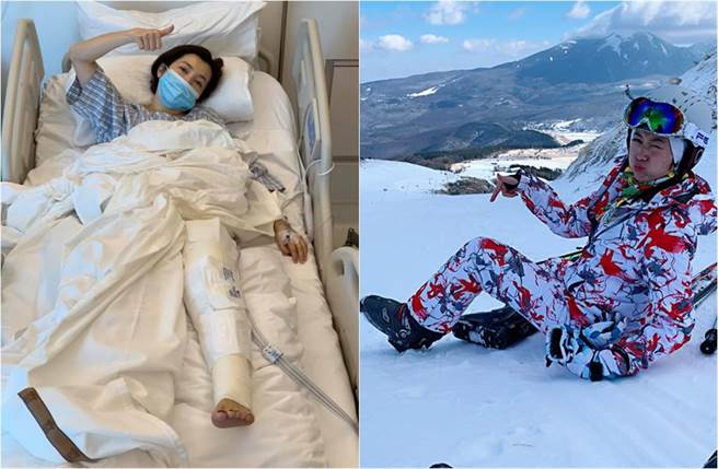 廖家仪韧带断裂，在香港养和医院接受手术。(取材自廖家仪的粉丝团脸书)