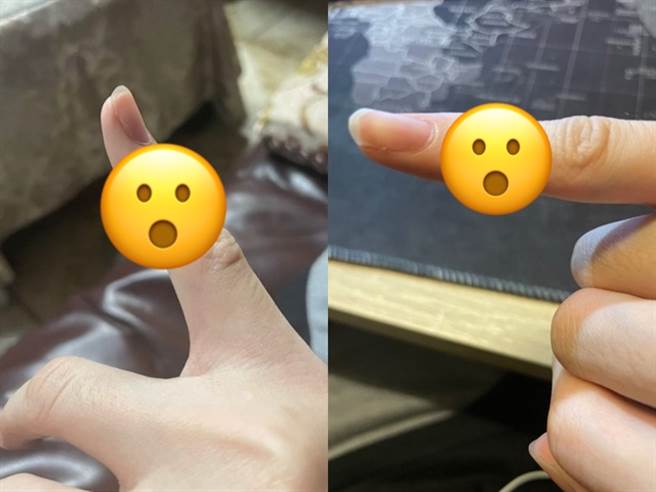 男子拿iPhone 12 pro不到5分钟，小拇指就被手机压出凹洞，而且相当痛。（图／翻摄自Dcard）