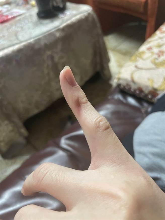 男子拿iPhone 12 pro不到5分钟，小拇指就被手机压出凹洞，而且相当痛。（图／翻摄自Dcard）