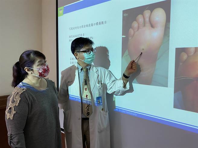 中山附医高压氧中心主任林任家指出，何女士（左）一开始右脚伤口只有针孔大小。（冯惠宜摄）