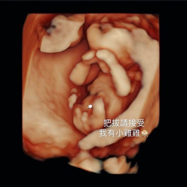 林可彤乐晒二宝超音波照片。