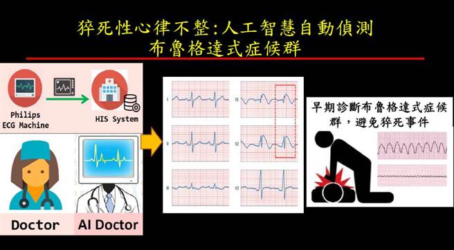 臺北荣总与三军总医院联手出击，推出以AI精准判读，即时抢救猝死性心律不整的智慧行动装置。(图/台北荣总提供)
