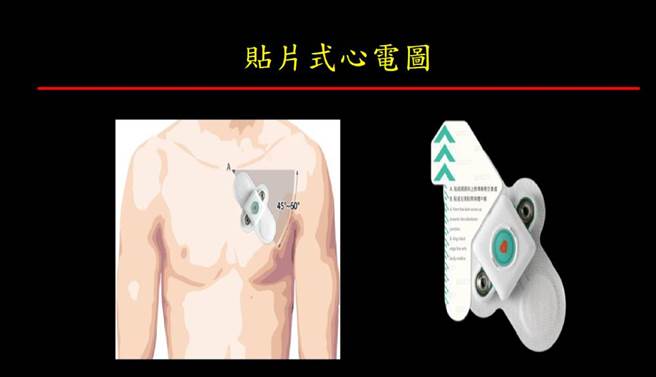 贴片式心电图。(图/台北荣总提供)