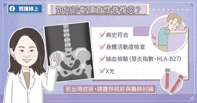 要诊断患者是否罹患僵直性脊椎炎，医师需要了解病史，患者下背痛的状况是否已经超过三个月、是否符合晨间僵硬、经休息无法改善等典型特徵。(图/照护线上提供)