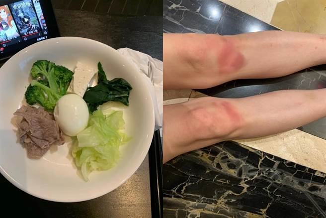 小S公布自己双腿瘀青照与菜单，让网友大讚太佩服了 (图/ 小S 徐熙娣脸书)