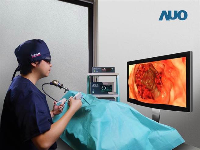 友达32吋4K偏光式3D显示器解决方案，结合友达最新3D显示技术与承鋆生医内视镜2D转3D立体影像科技。图／袁颢庭