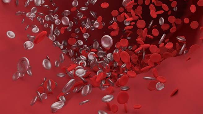 一般產生血栓機率最高是手術當天，產生血栓的患者有5成在第一天就發生。預防血栓黃金48小時，醫師表示，物理性效果更佳。(示意圖/Pixabay)
