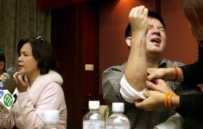 郭美珠(左)记者会上痛斥周又珈，胞弟郭益宏神情痛苦地展示手臂上被殴打的伤口。（图／中时资料照）