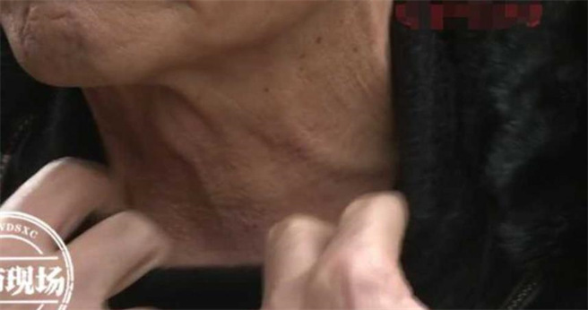 老翁为了回春砸下数百万做医美，效果却不如预期。（图／翻摄自都市现场，下同）