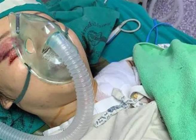 怀孕妻遭丈夫预谋推落悬崖，大难不死后竟表示仍相信爱情。（图／东网）