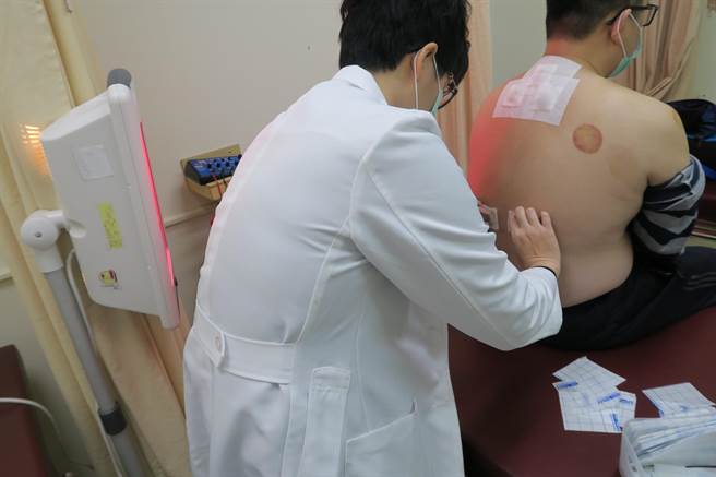 「三九贴」是传统中医对慢性病、虚寒性疾病的保养方法，从冬至开始每9日1数，进行穴位的中药敷贴，一共3次，所以称为「三九贴」。（吴建辉摄）