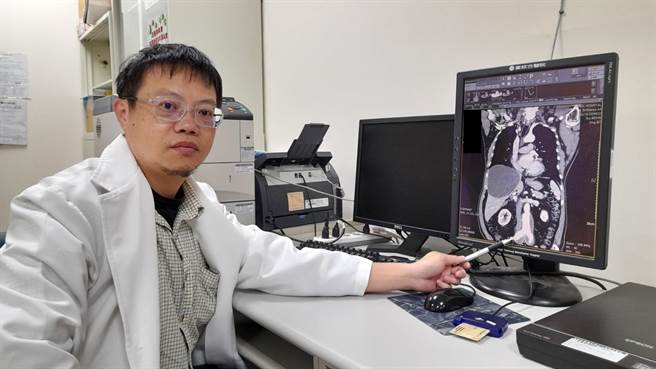 李志贤医师笔指处即为一处腹主动脉瘤与两处肠骨动脉瘤位置。（童综合提供／陈淑娥台中传真）