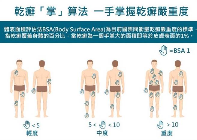 乾癬患者可用手掌面積統計身上乾癬病灶覆蓋率，掌握自身病情。(圖/ 台灣乾癬暨皮膚免疫學會、康健雜誌提供