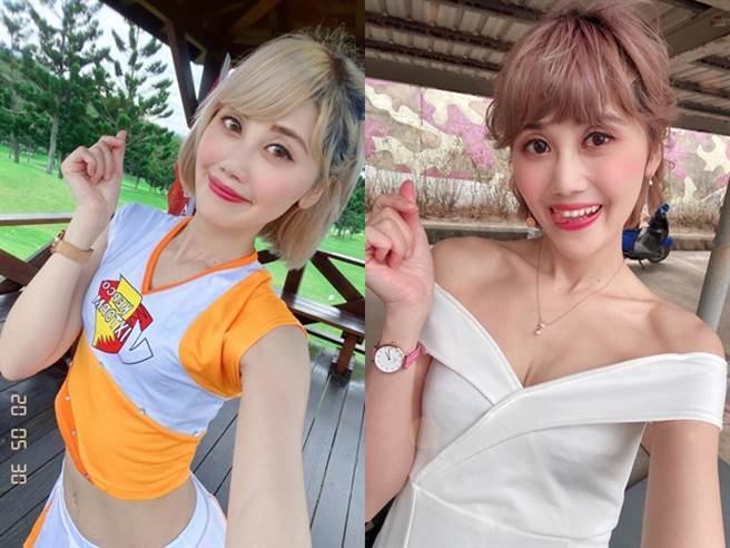 林裕庭（豆芽Sandy）因不明原因右眼患失明4个月，现已接受角膜移植復原了。（图／翻摄自豆芽Sandy脸书）