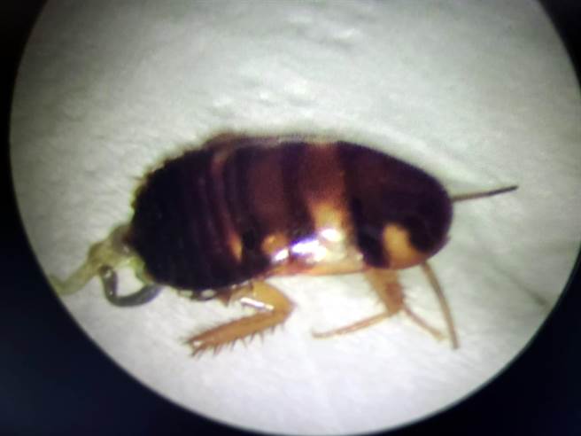 台東1名女子24日煮飯時遭蟲子鑽入耳朵，痛到受不了趕緊就醫，耳鼻喉科醫師在她耳朵內夾出1隻1.2公分蟑螂，所幸未傷及女子耳膜，聽力也沒有受損。（余耳鼻喉科診所提供／蔡旻妤台東傳真）