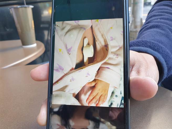 Eric的女儿罹患重度「脊髓性肌肉萎缩症发病」，出生3个月就发病，从小只能仰赖胃造口灌食物泥进食。（袁庭尧摄）