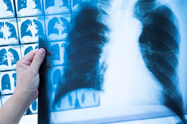 医师透过电脑断层扫描（Computed Tomography，简称CT）检查后，竟在女童体内发现卡通人物「佩佩猪」的身影。(示意图/Shutterstock)