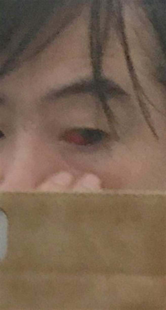 今井雄三眼睛充血，看起来状况很不好。(图/翻摄自今井雄三推特)