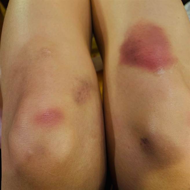 顏曉筠拍戲用盡全力，跪到雙腳全瘀青。（民視提供）