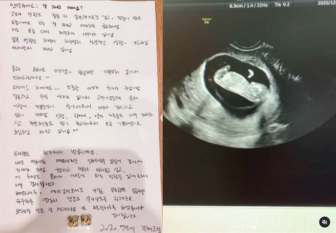 2020年12月31日，韩智慧在IG晒出超音波照报喜讯。(图/ 摘自韩智慧IG)