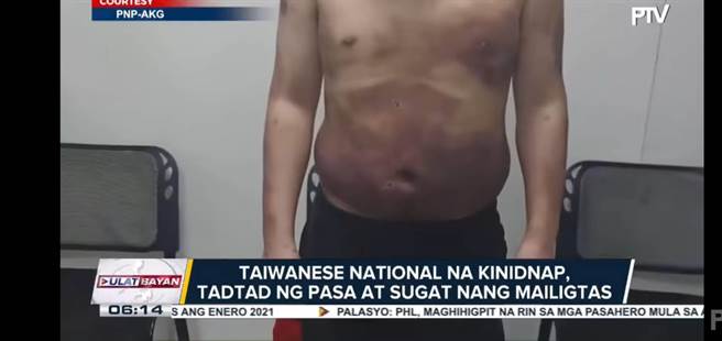 被害人遭拘禁期間被歹徒毆打，全身滿布傷痕。（翻攝網路）