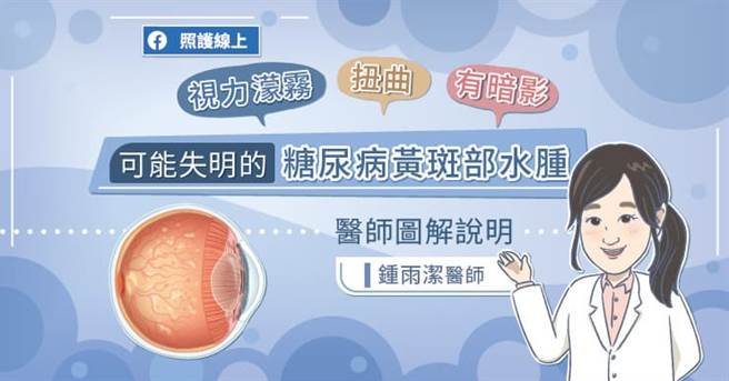 黄斑部水肿是最常被忽视的糖尿病共病之一。(图/照护线上提供)