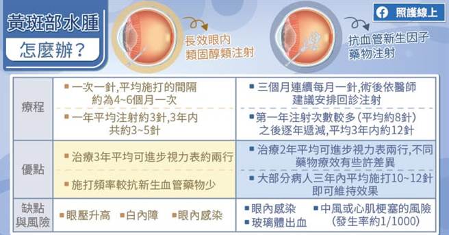 黄斑部水肿治疗途径。(图/照护线上)