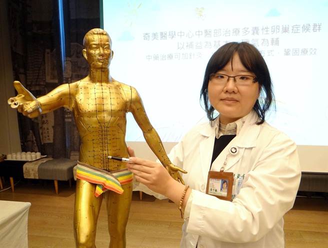 奇美医院中医师黄千毓说明针灸治疗。(曹婷婷摄)