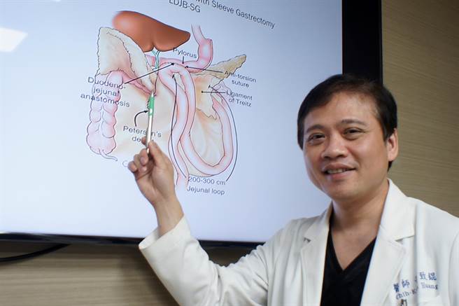 中国医药大学附设医院国际代谢形体医学中心院长黄致锟提醒，BMI值大于30的代谢症候群患者因心血管猝死风险是正常人的三倍。（冯惠宜摄）