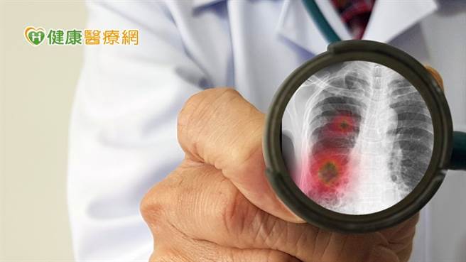 流感患者若同时金黄色葡萄球菌感染，容易引发菌血症。(图/健康医疗网提供)