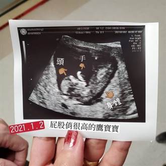 葉瑋庭喜懷混血寶寶 分享超音波照宣告當媽