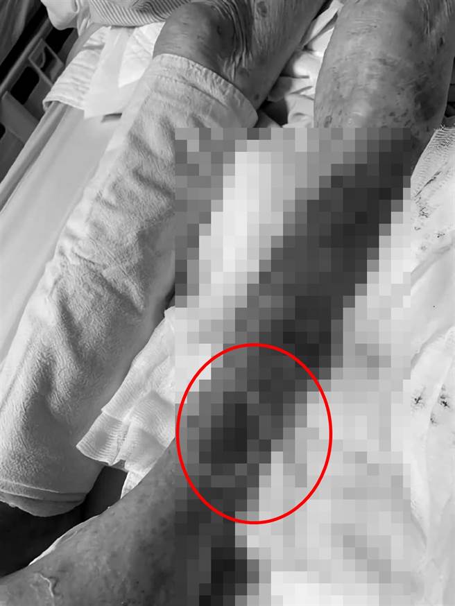 台南市一名９旬阿嬤日前被發現倒臥田中生命垂危，腳上還有咬傷痕跡，醫護搶救後挽回一命，家屬則質疑遭到野狗攻擊。（讀者提供／莊曜聰台南傳真）