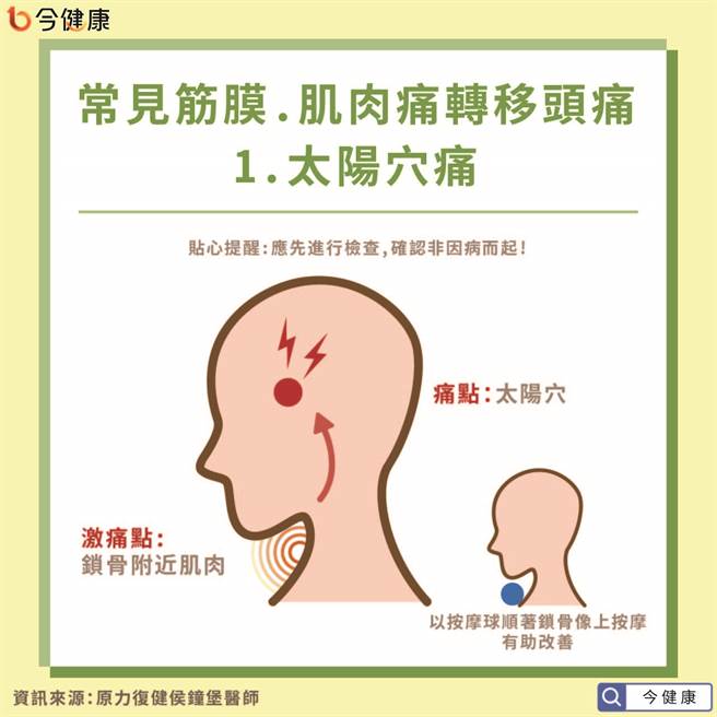常见因转移疼痛的头痛问题-太阳穴疼痛。(图/今健康提供)