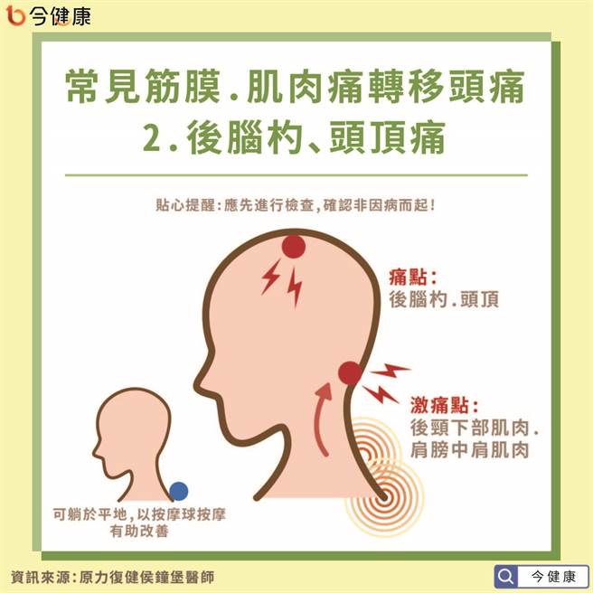 常见因转移疼痛的头痛问题-后脑杓、头顶痛。(图/今健康提供)