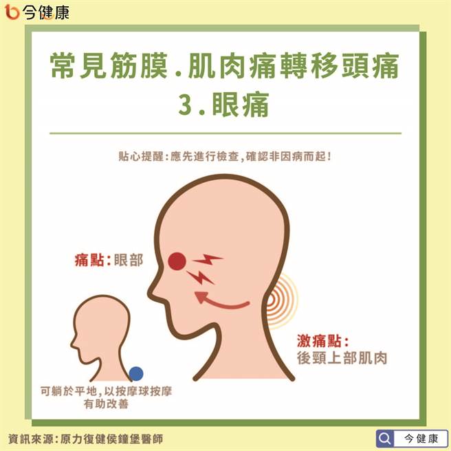 常见因转移疼痛的头痛问题-眼痛。(图/今健康提供)