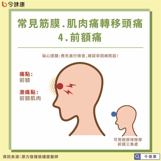 常见因转移疼痛的头痛问题-前额痛。(图/今健康提供)