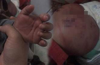3歲童挨打屁股瘀青驗傷 動手燒烤店老闆遭社會局開罰