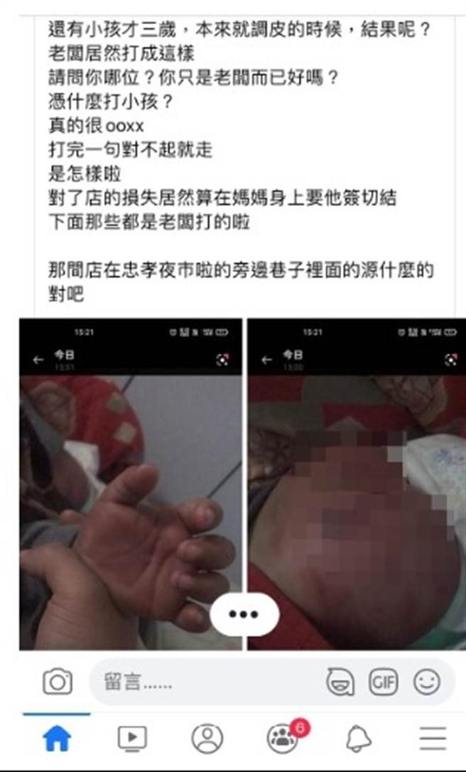 网友PO网指称台中南区一家烧烤店老板将单亲店员3岁小孩打到屁股淤青。（翻摄自爆料公社）