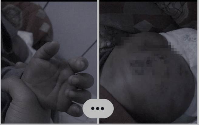 单亲母请烧烤店老板管教小孩，狂殴屁股全瘀血恐重罚60万。(翻摄爆料公社)