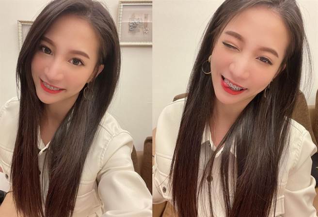 林采缇近期宣布自己开始当钢牙妹，面对酸民高EQ回应被不少粉丝讚赏。(图/ 摘自林采缇IG)