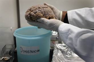 失智症與帕金森氏症救星 美發現清除腦部有毒蛋白的方法