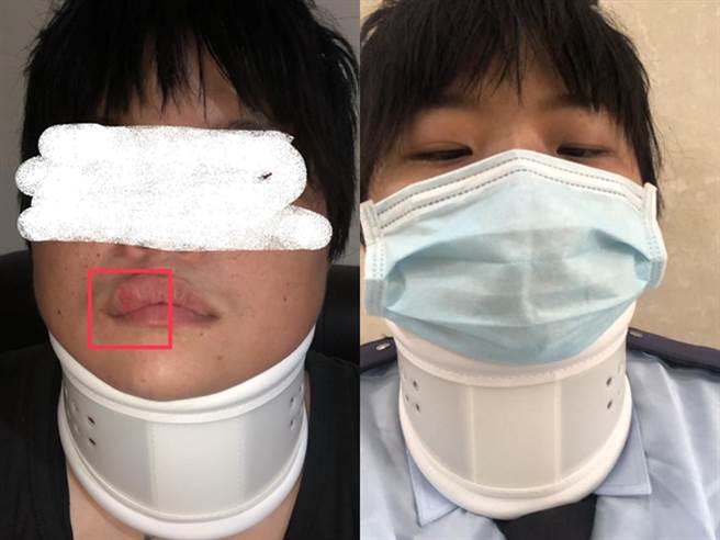 在台中三井Outlet担任保全的男子上班时遭缆绳绊倒、颈椎受伤，控诉公司强迫他带伤上班、消极受理职业灾害等事。（图／翻摄自脸书爆料公社）