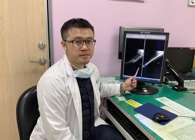 光田综合医院骨科医师严可伦指出脂肪粒从断骨处释放散出。（光田综合医院提供／陈淑娥台中传真）