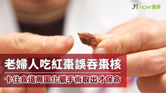 彰基急诊观察室主任医师倪渟渊提醒，如果误食卡住喉咙，使用错误的方法恐怕让医师处置更困难，立即挂急诊请医师夹出最安全。（图／彰化基督教医院、NOW健康提供）