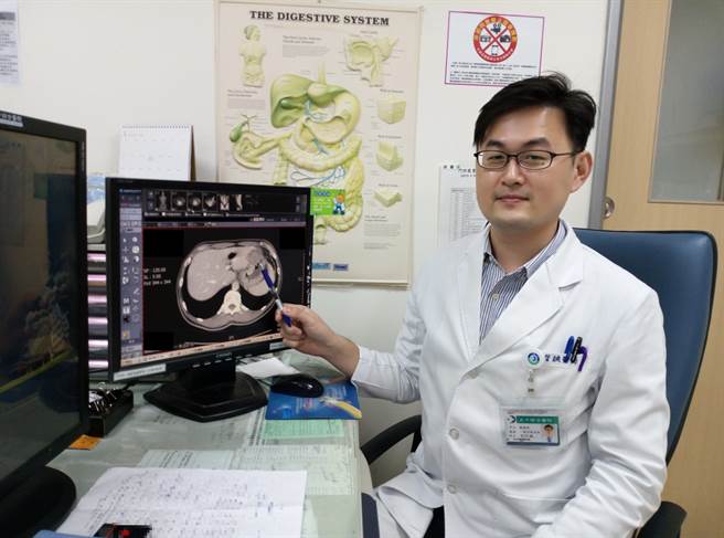 大千综合医院一般外科主任刘信诚表示，吴先生的状况无法排除有恶性肿瘤的可能性，因此建议他做正子造影检。（大千医院提供／何冠娴苗栗传真）