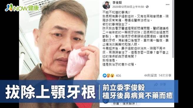 前立委李俊毅上颚牙根烂酿鼻窦炎，植牙后鼻病不药而癒。(图/健康医疗网提供)