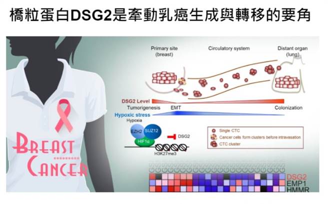 乳癌復發、移轉 中研院研究發現：與它的含量有關 - 健康 - 中時新聞網